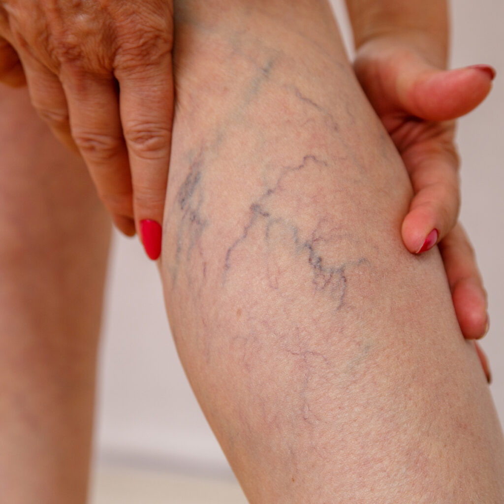 aaclinic cirugia vascular ourense