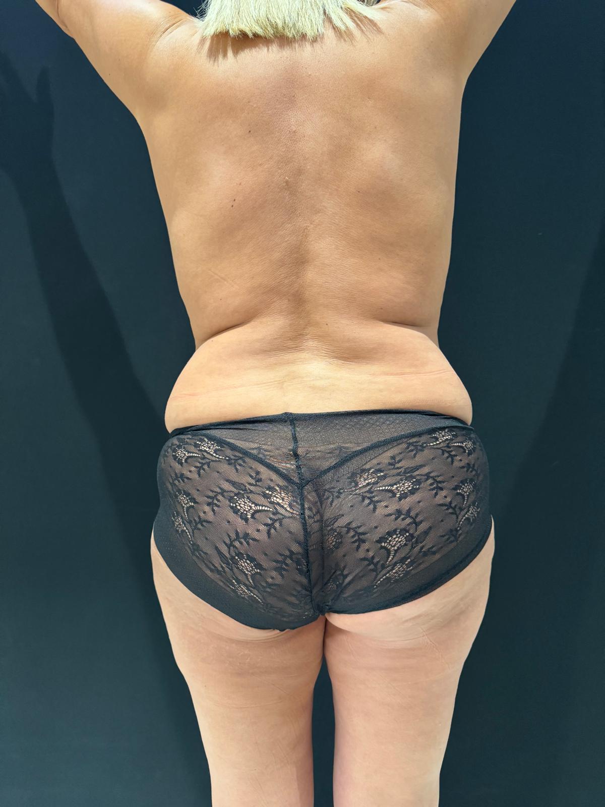 WhatsApp Image 2025-10-30 at 17.17.05