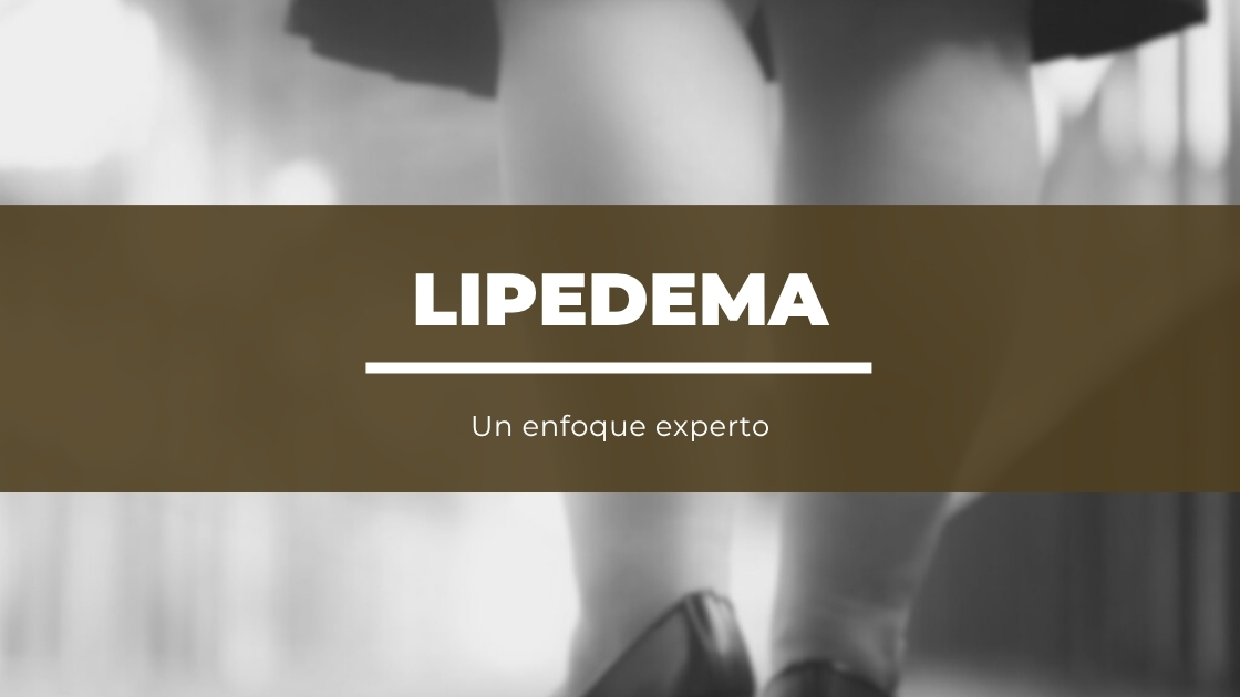Lipedema: Un enfoque experto