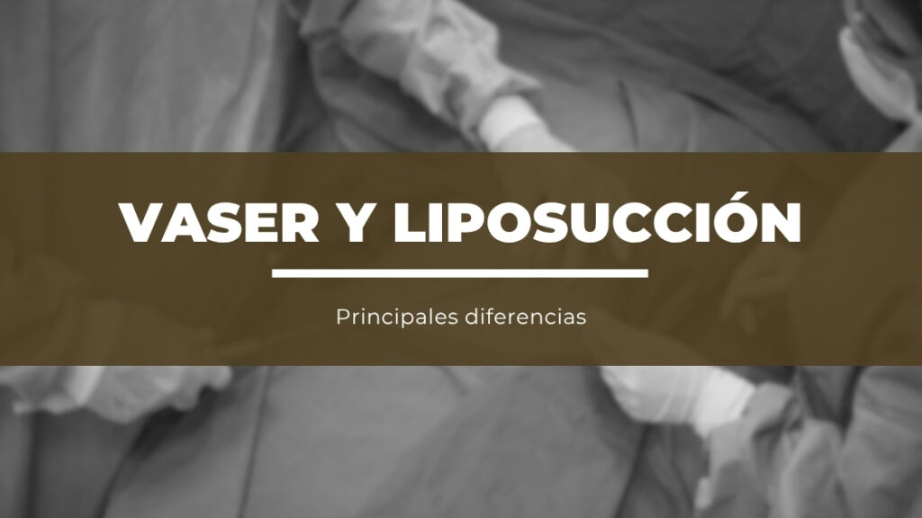 Diferencias Entre Lipo Vaser y Liposucción Tradicional