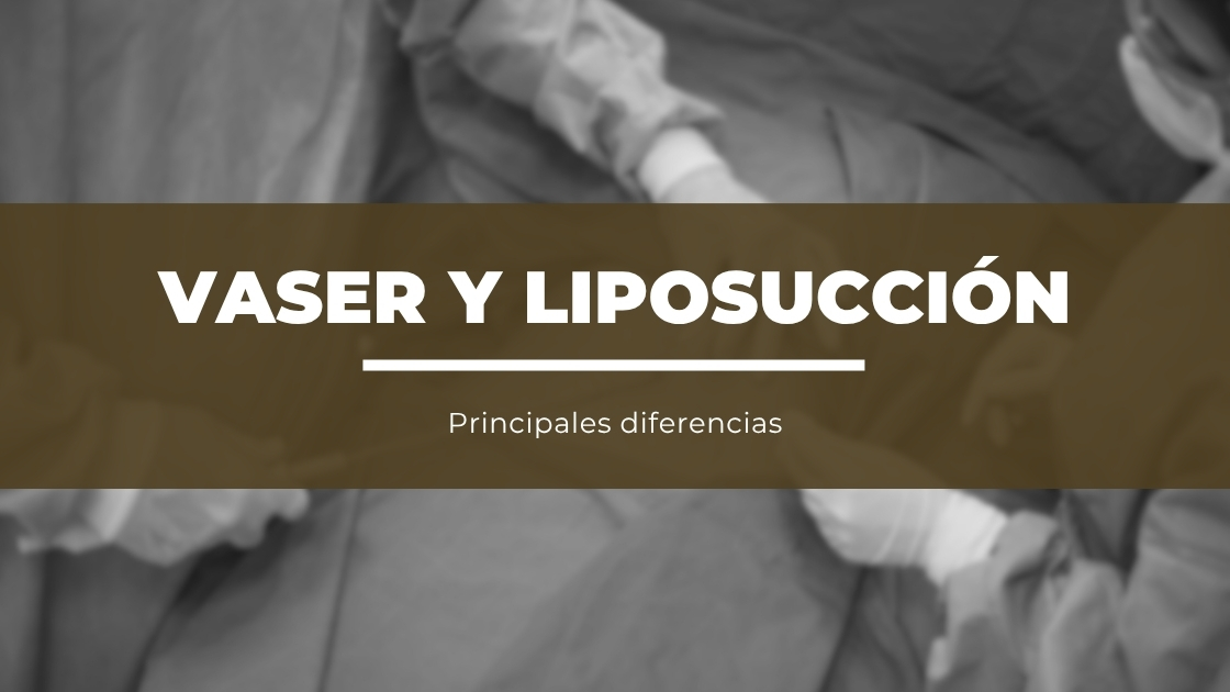 Diferencias Entre Lipo Vaser y Liposucción Tradicional
